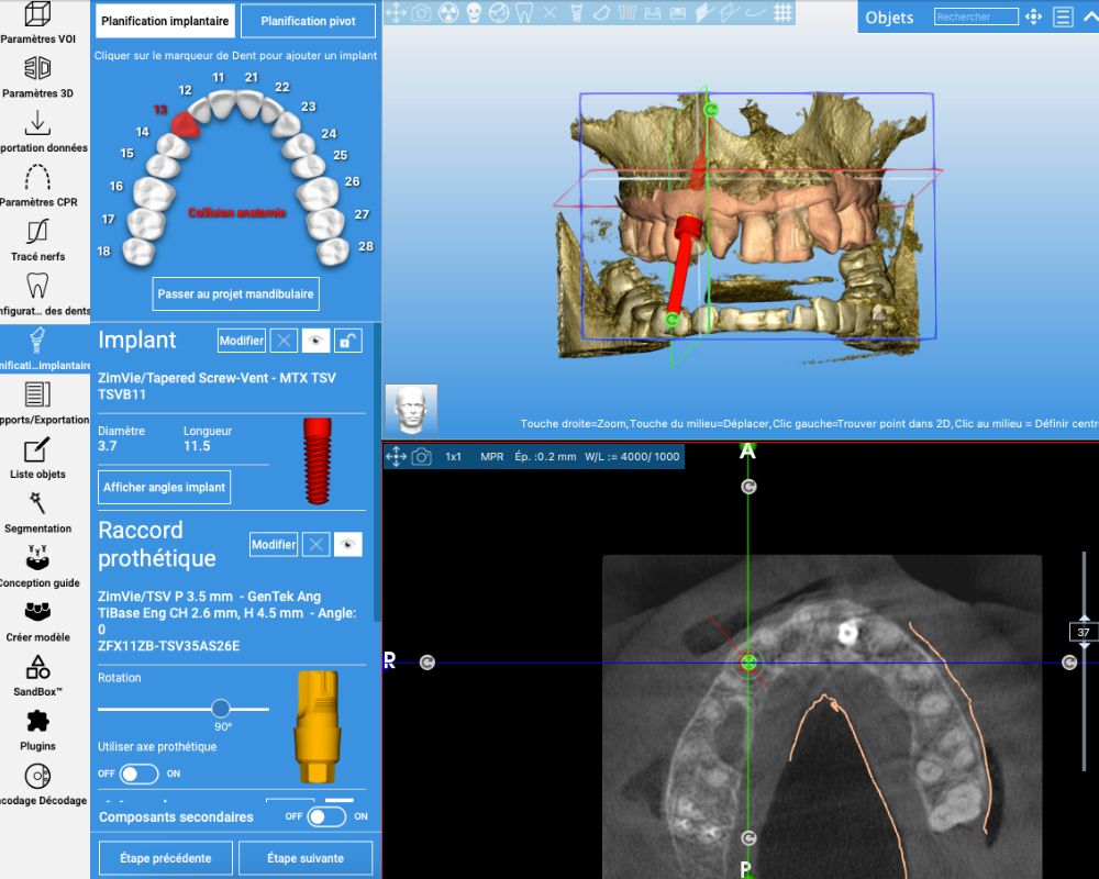 Dr Francois Brutails - Dentiste - Vars - la Boixe - Planification